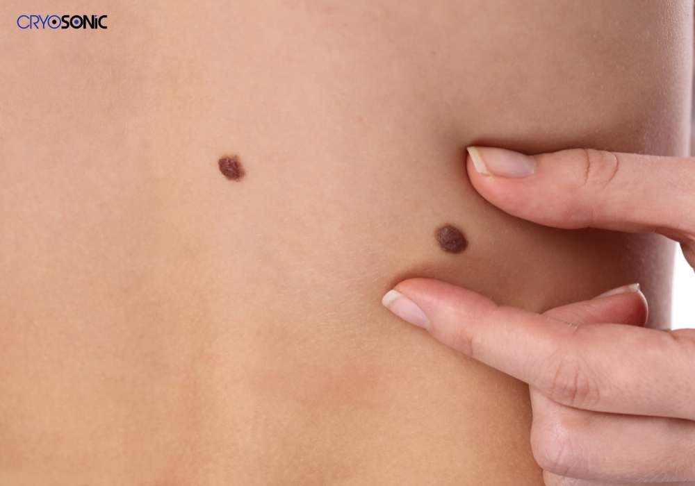 Infection Risk and Poor Aftercare Fareham