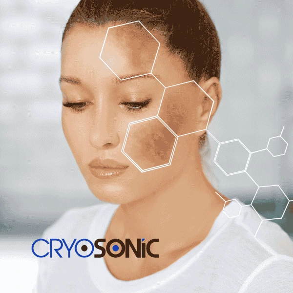 Are you looking for age spot removal treatment? Contact Cryosonic today in Fareham