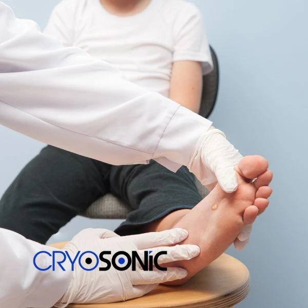 Are you looking for fast effective wart removal Contact us today Fareham