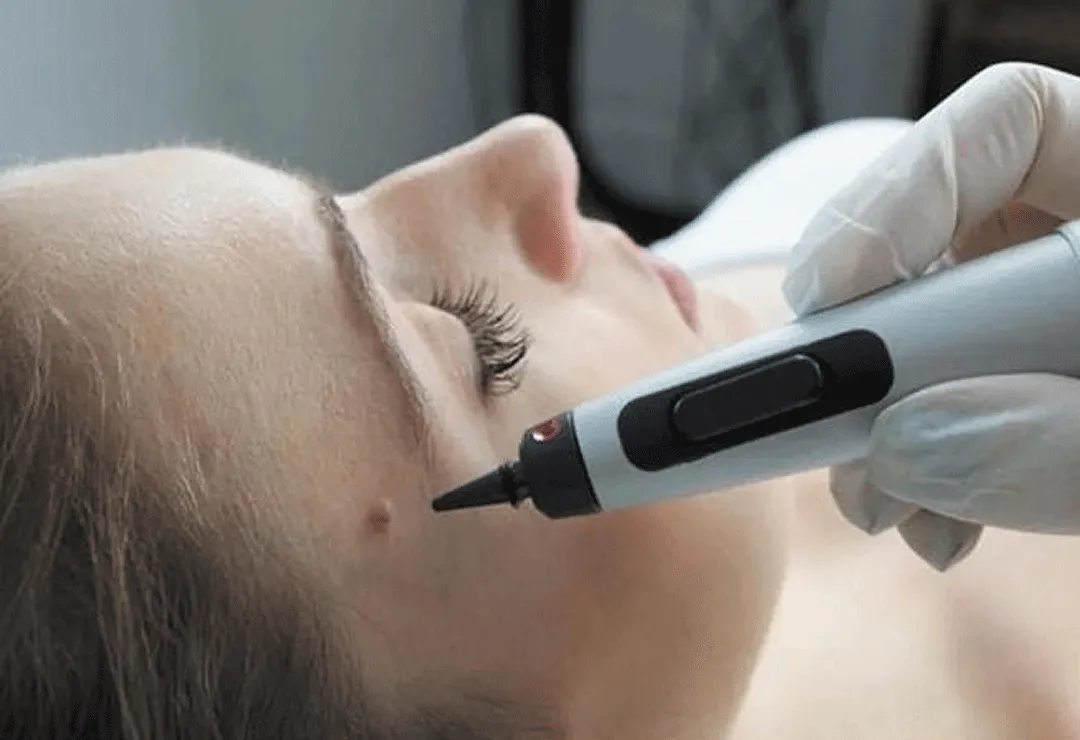 FAQs: Here's Everything You Need to Know About At-Home Cryotherapy Fareham